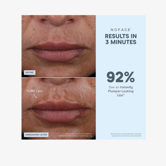 NuFace FIX MicroWand - *BNIB* - Picture 6 of 6